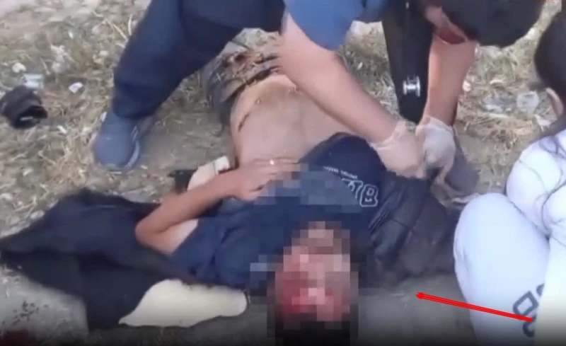 Yaralı, müdahale, Şok! Doktorun kazada müdahale ettiği yaralı, beraber çalıştığı hemşire çıktı 
