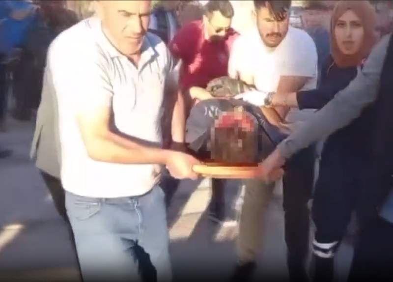 Yaralıyı taşıyorlar, Şok! Doktorun kazada müdahale ettiği yaralı, beraber çalıştığı hemşire çıktı