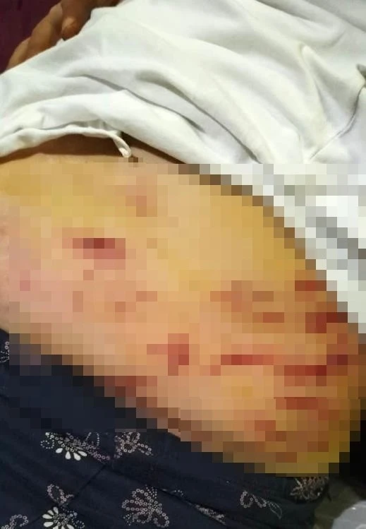 Sokakta ağızlıksız gezdirilen ‘Rottweiler’ dehşet saçtı: Kadına ve kuryeye saldırdı, kilis kent haber