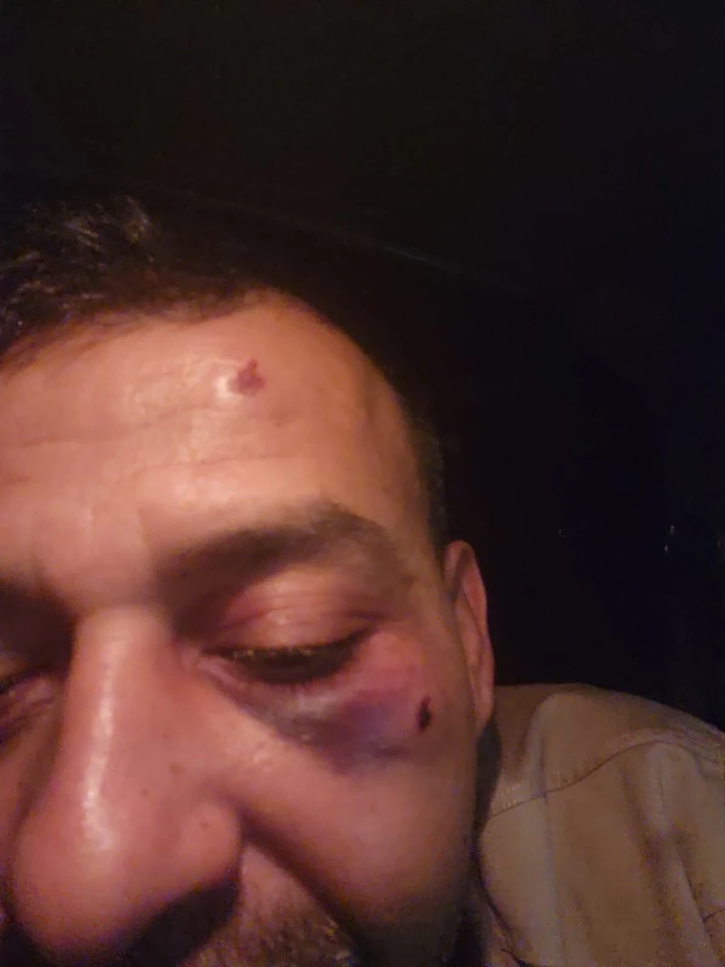 Kukla sanatçısına darp iddiası: Eşi ve ailesi gözaltı talebiyle şikâyet edildi, kilis kent haber, asayiş