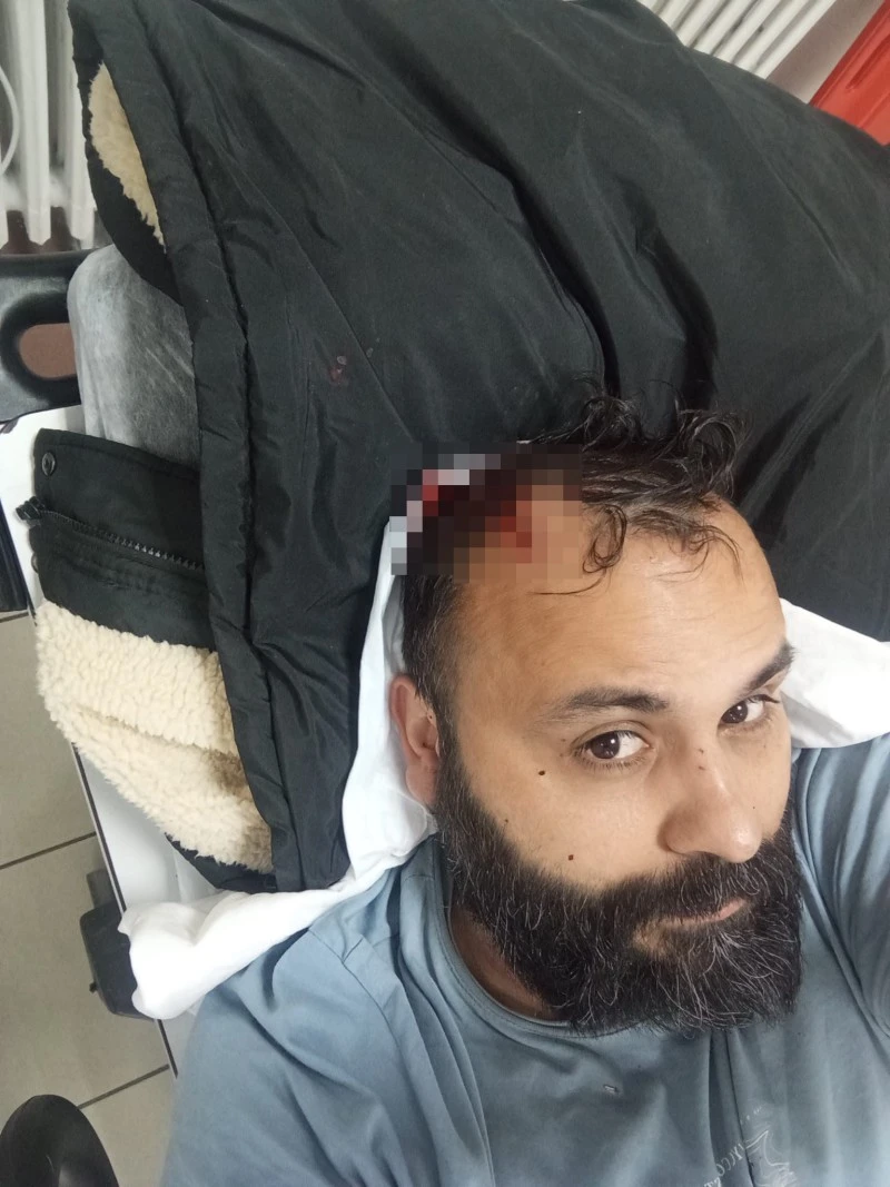 Kukla sanatçısına darp iddiası: Eşi ve ailesi gözaltı talebiyle şikâyet edildi, kilis kent haber, asayiş