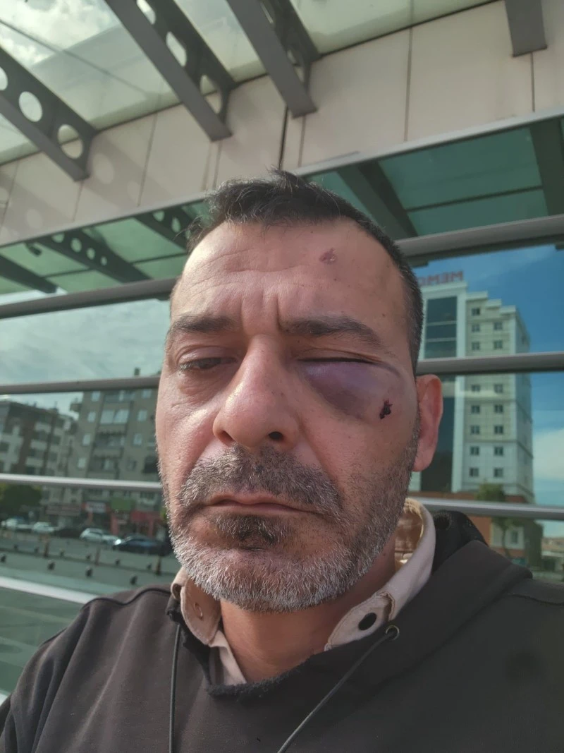 Kukla sanatçısına darp iddiası: Eşi ve ailesi gözaltı talebiyle şikâyet edildi, kilis kent haber, asayiş