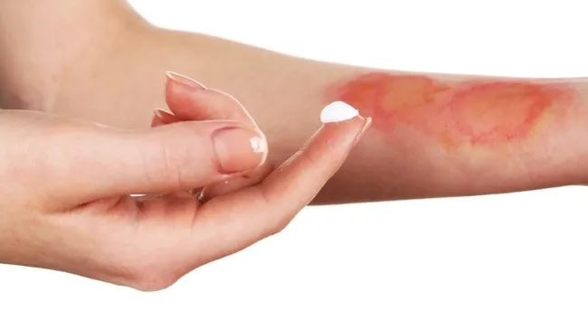 Yine sıcak su torbası yine facia: "Koyduktan 3 dakika sonra patladı"