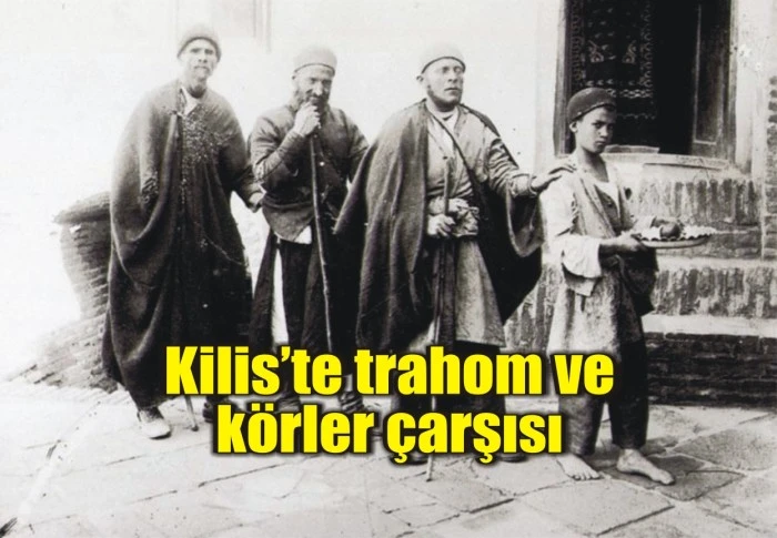 Kilis’te trahom ve körler çarşısı