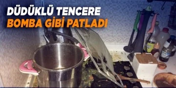 8 yaşındaki çocuğun üzerine tencere patladı