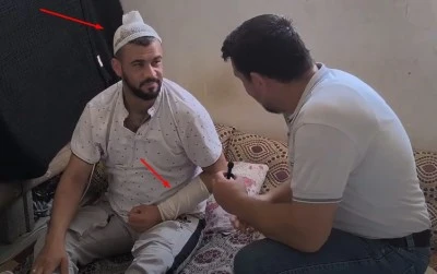 Kilis'te Belediyenin Çukura Düştü, Ölümden Döndü