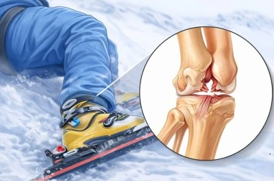 Burkulma ve kırıklara karşı uzmanlardan uyarı