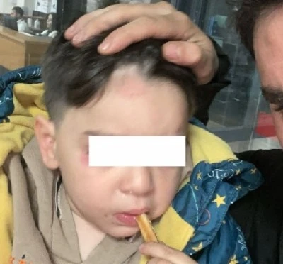 Kilis’te Annesi Tarafından 3 Yaşındaki Çocuk Darp Edildi