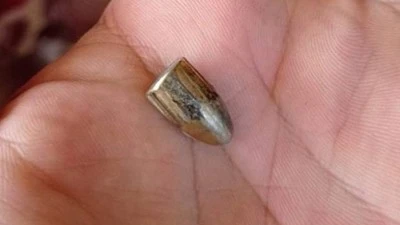 Kilis’te Bağ Evinde Otururken Silah ile Dizinden Vuruldu