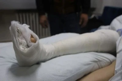  Kilis&rsquo;te İzni Olmadan Turnuvaya G&ouml;t&uuml;r&uuml;len &Ccedil;ocuk Yaralandı