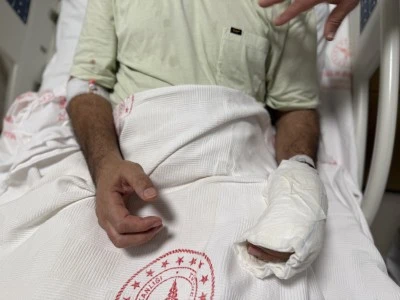 Sıcak Su Torbası 5 Dakikada Patladı: V&uuml;cudunun Y&uuml;zde 30&rsquo;u Yandı