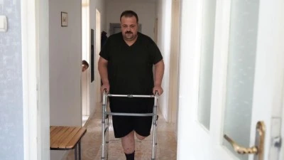 Tedavi için gitti, ayağı kesildi