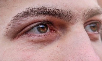 Uzun Ekran Kullanımı Görmeyi Kalıcı Olarak Etkileyebilir